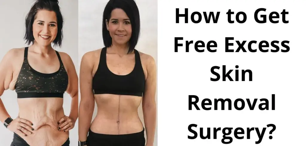 free skin removal surgery after weight loss