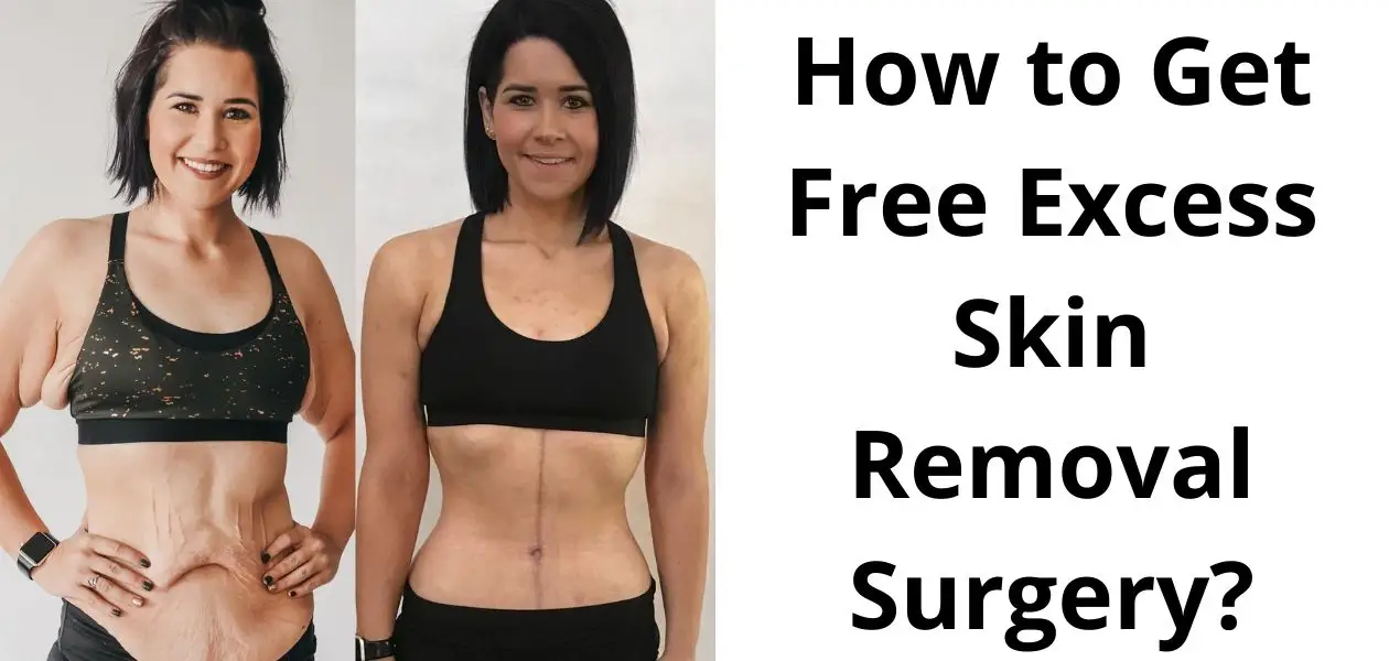 Free Excess Skin Removal Surgery How & Top 5 Places (2023)